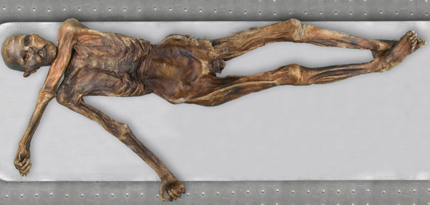 Ötzi the Iceman in his preservation cell