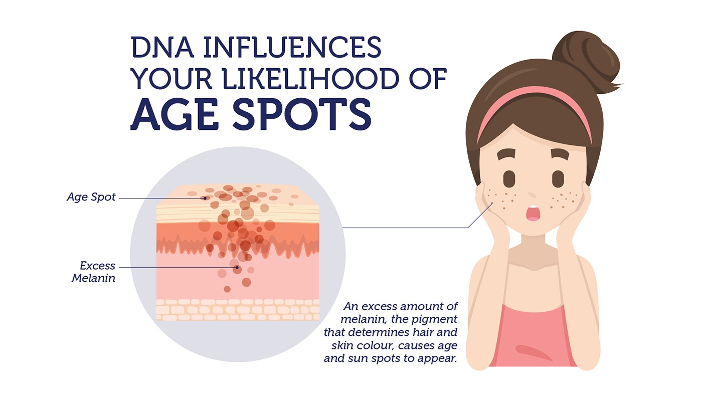 Did You Know Dna Influences Your Likelihood Of Developing Age Spots Did You Know Dna
