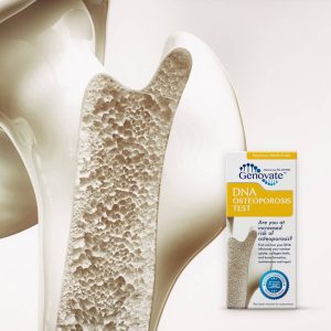 DNA Osteoporosis Test